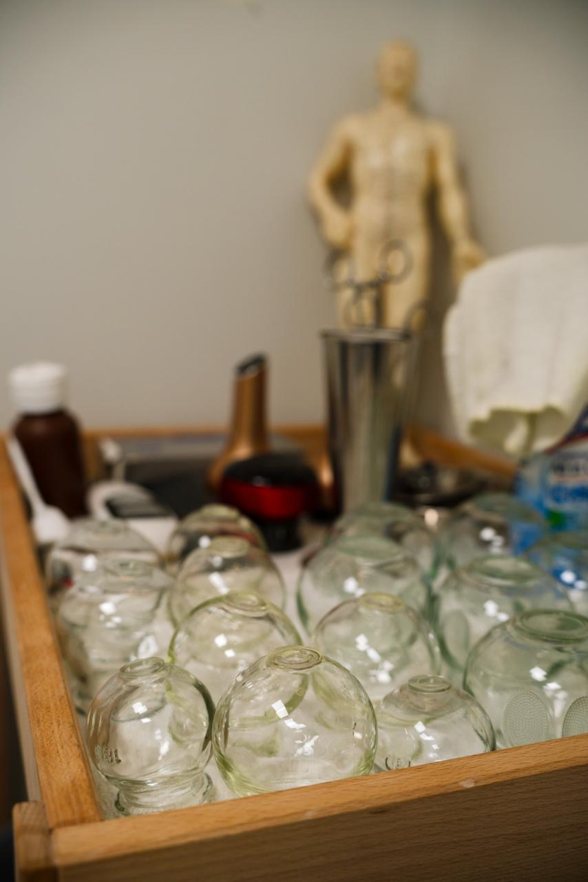 Accupuncture in Edmonton - experienced therapist