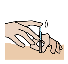 Accupuncture in Edmonton - healing and rejuvenation